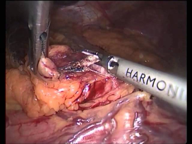 Belgium surgery services