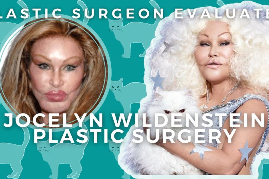 Cat lady surgery