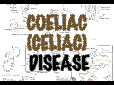 Celiac disease