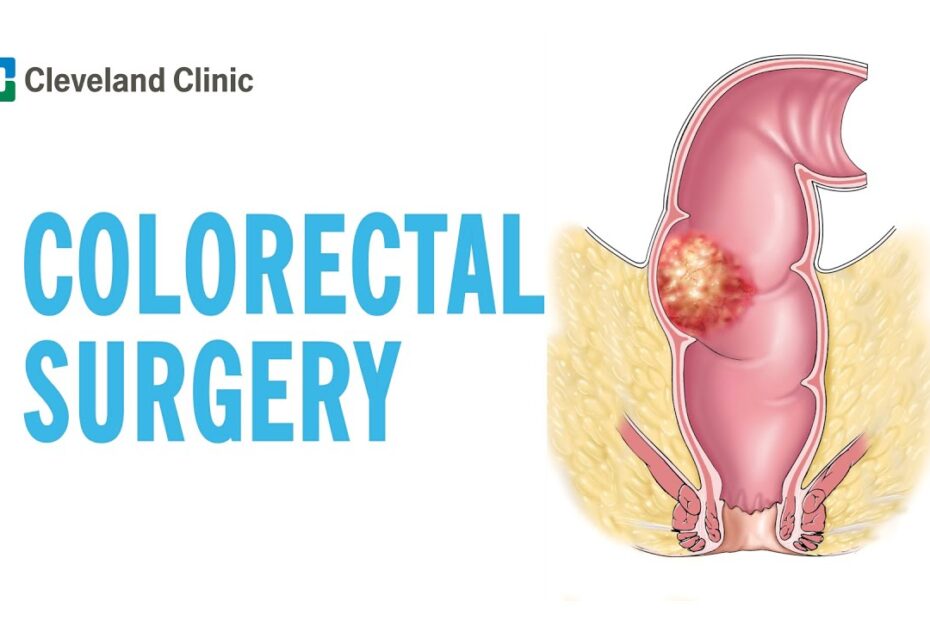 Colorectal surgery