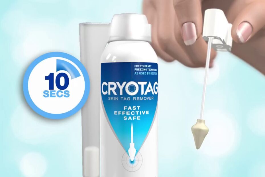 Cryotag skin tag remover