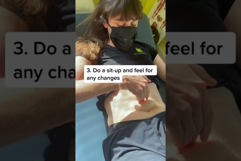 Diastasis recti