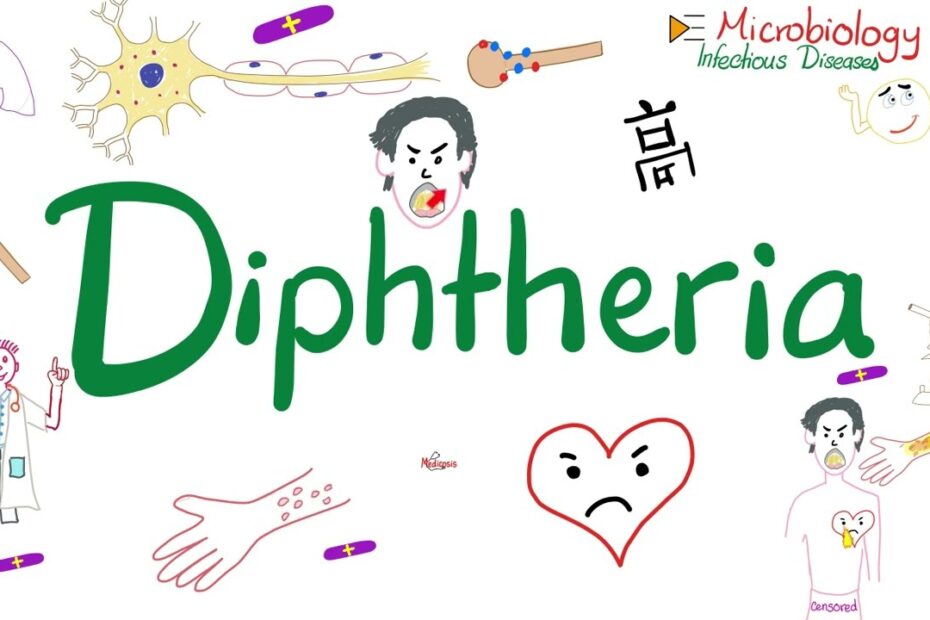 Diphtheria