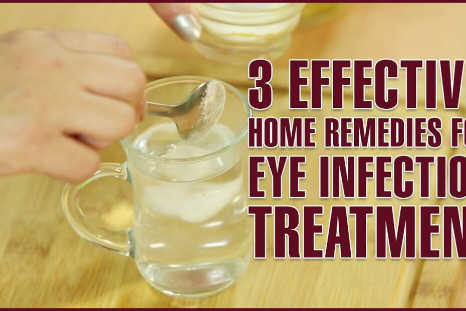 Home remedies for eye infection