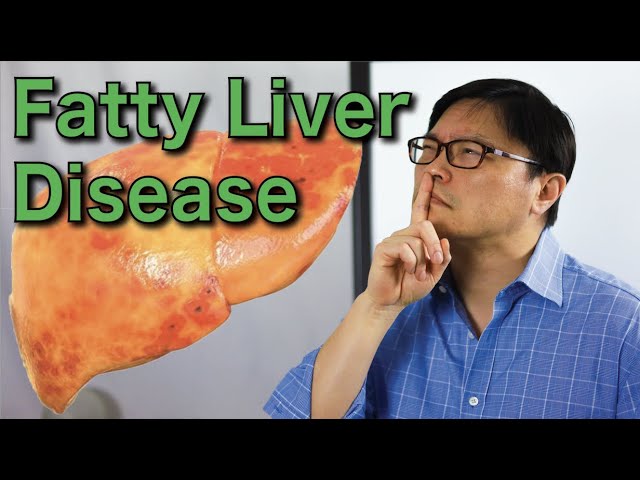 How To Cure Fatty Liver Disease