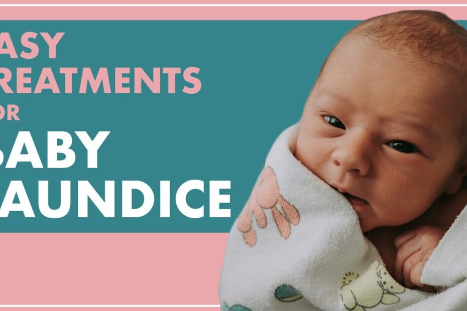 How to cure jaundice in newborn at home