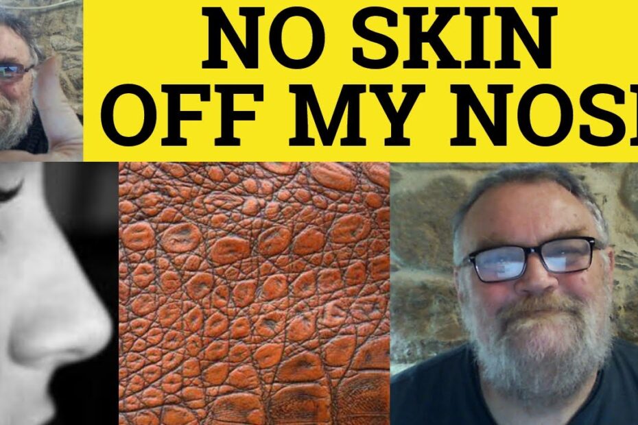 No skin off my nose