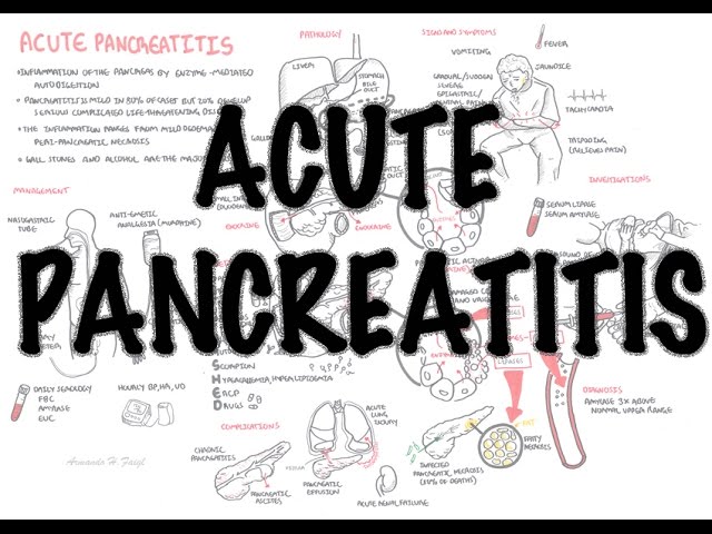 Pancreatitis