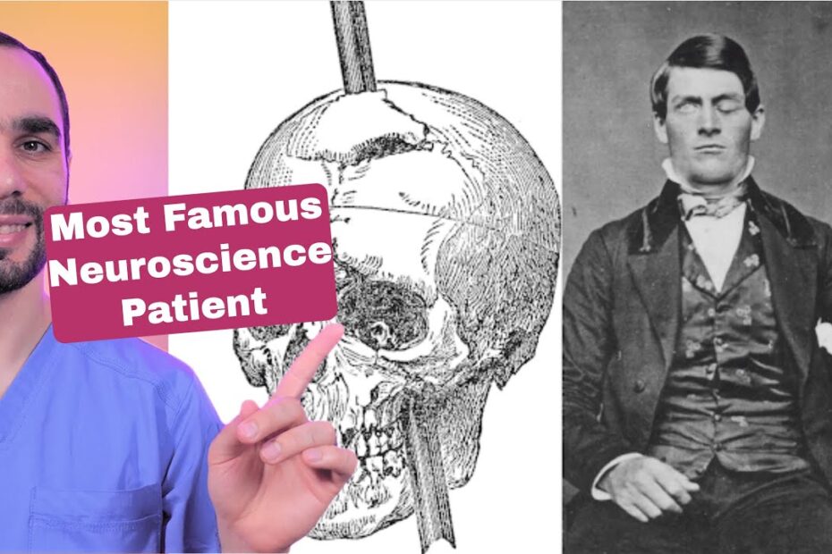 Phineas Gage