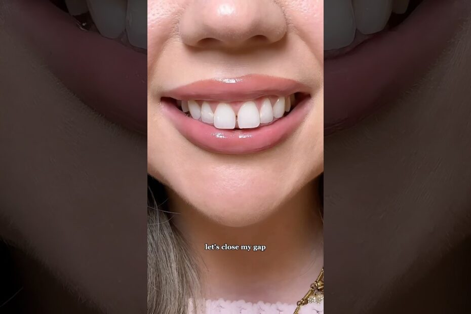Smile makeover dentist near me