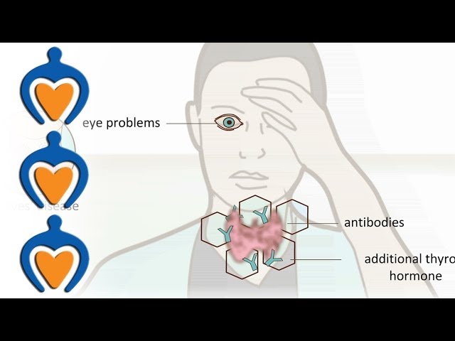 Symptoms of thyroid issues in women