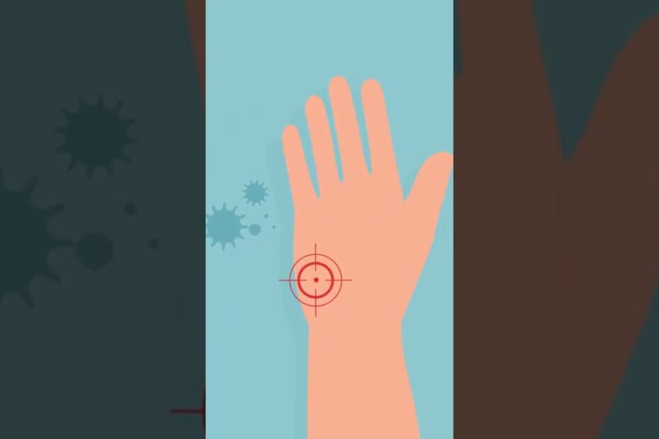Tetanus symptoms