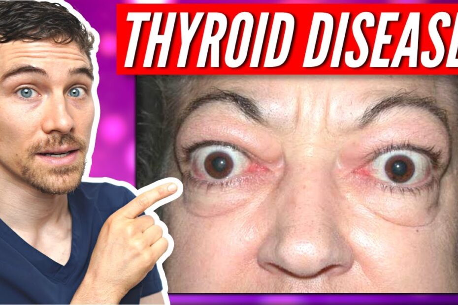 Thyroid eye disease