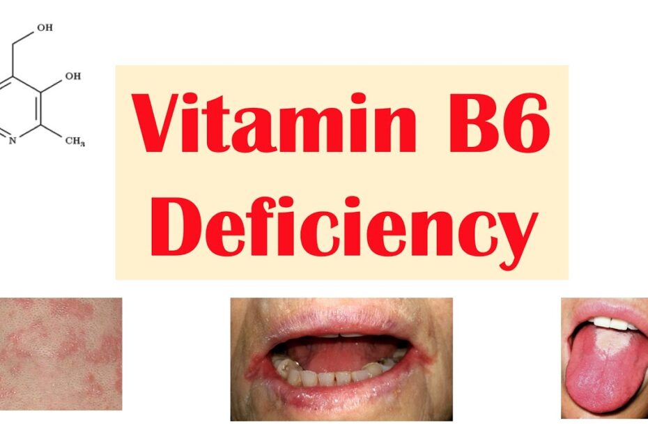 Vitamin b6 deficiency
