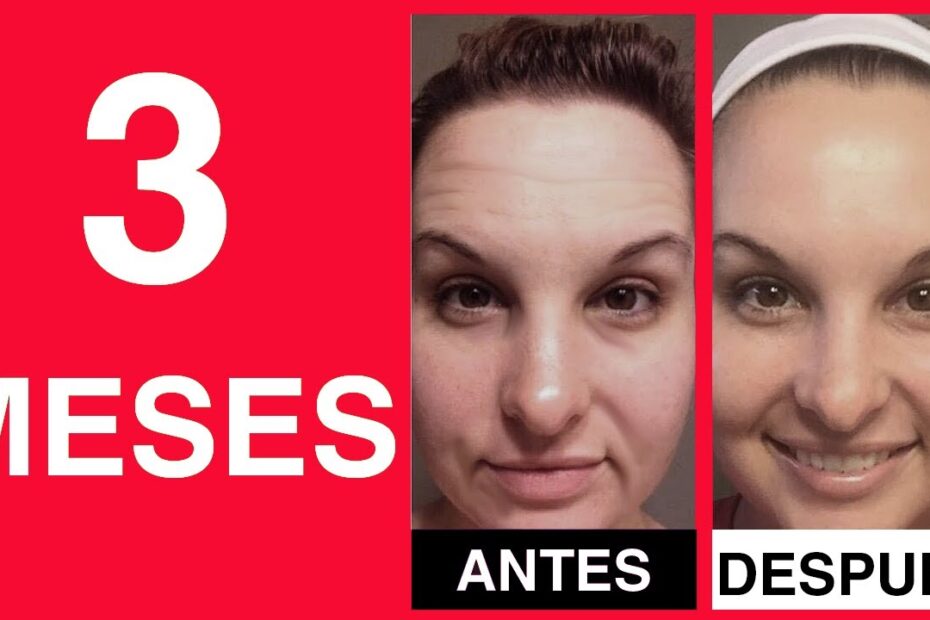Vitamina a para que sirve en la piel