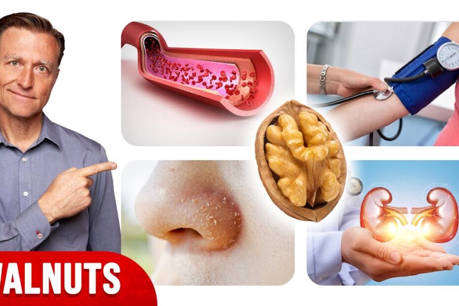 Walnut nutrition