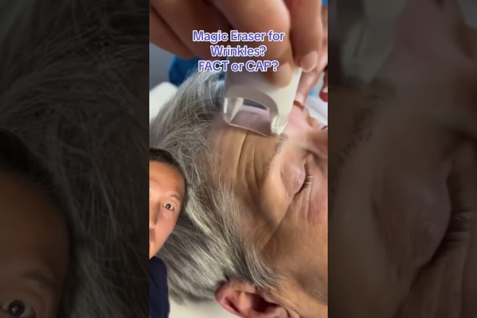 best facial treatment for wrinkles