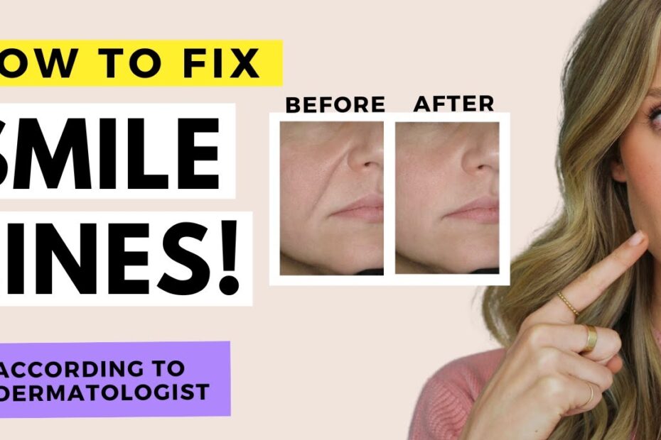 best treatment for deep wrinkles around mouth