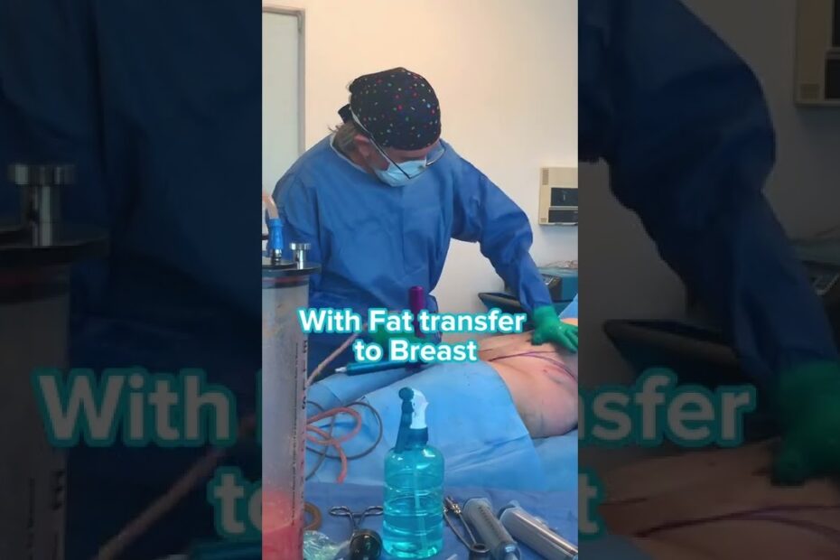 breast augmentation with lift pictures