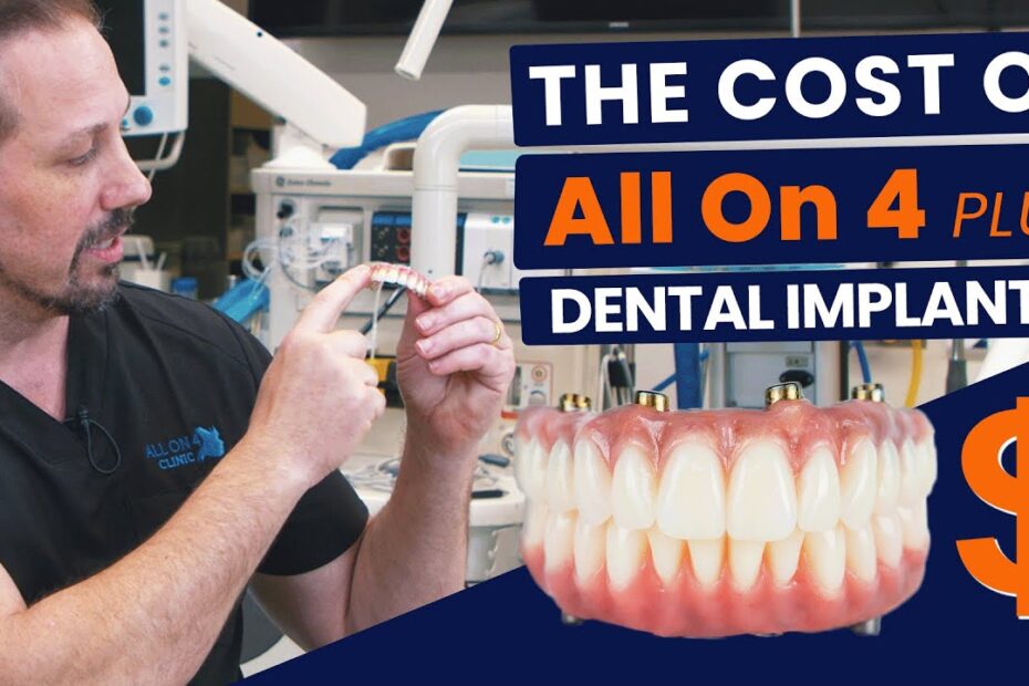 full dental implants in one day