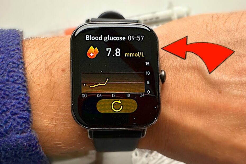 glucose smartwatches