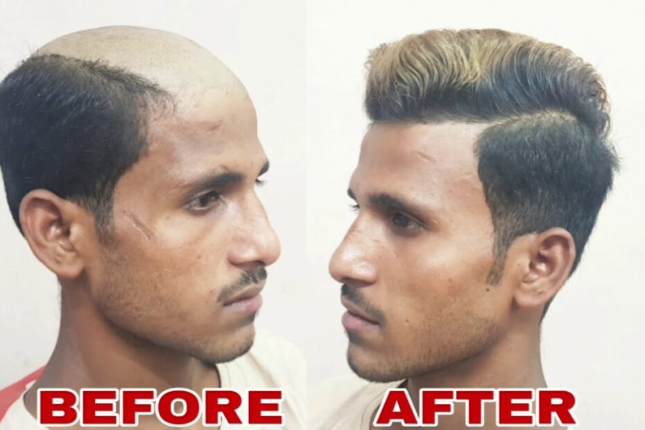 hair patch manufacturer