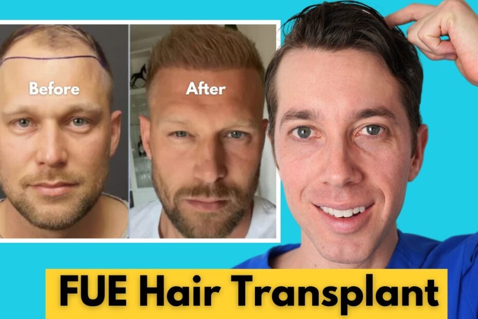 hair transplantation