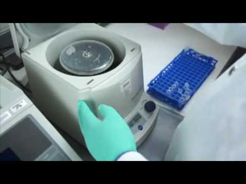 hiv monitoring and adjustments