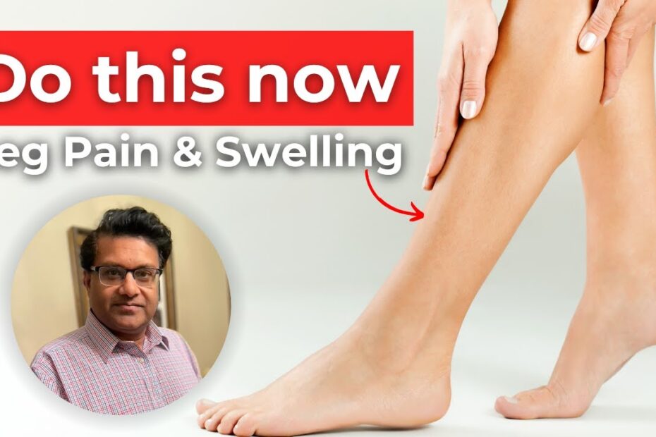 how to check for a blood clot in your leg