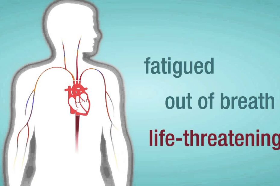 how to know if you have heart valve issues