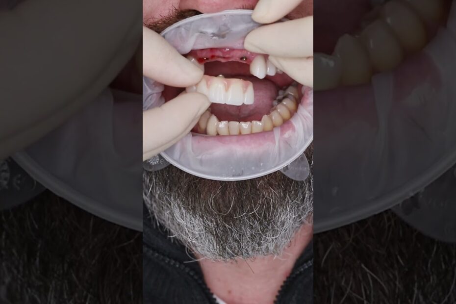 implant dentist nearby