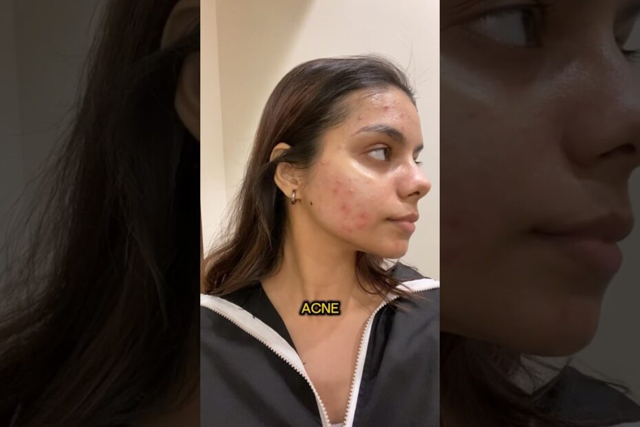 laser treatment clinic near me