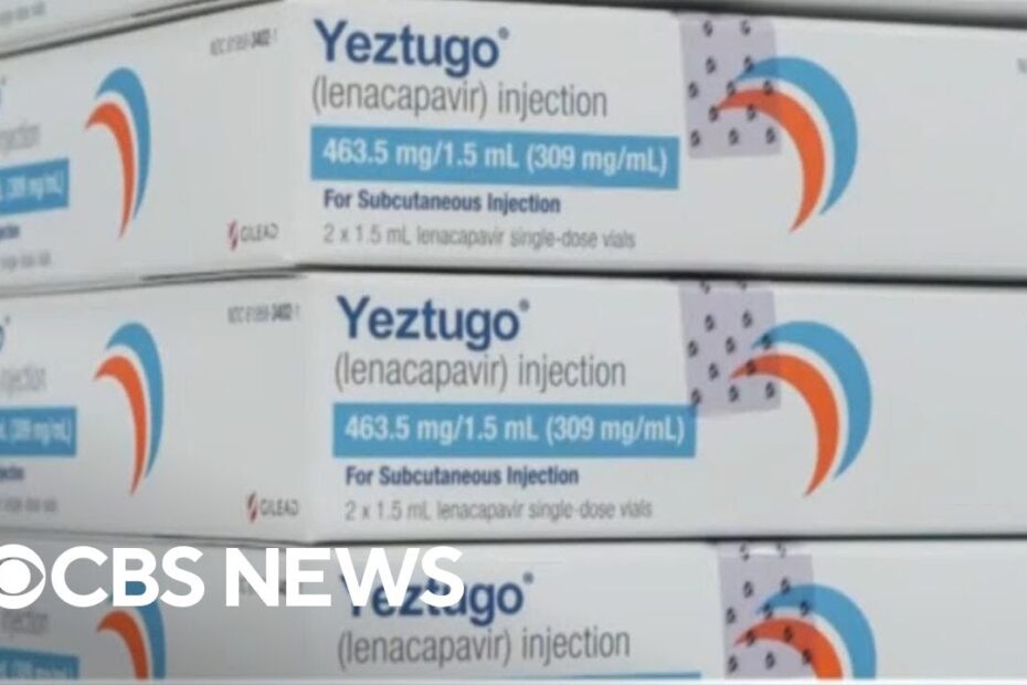 single trial hiv
