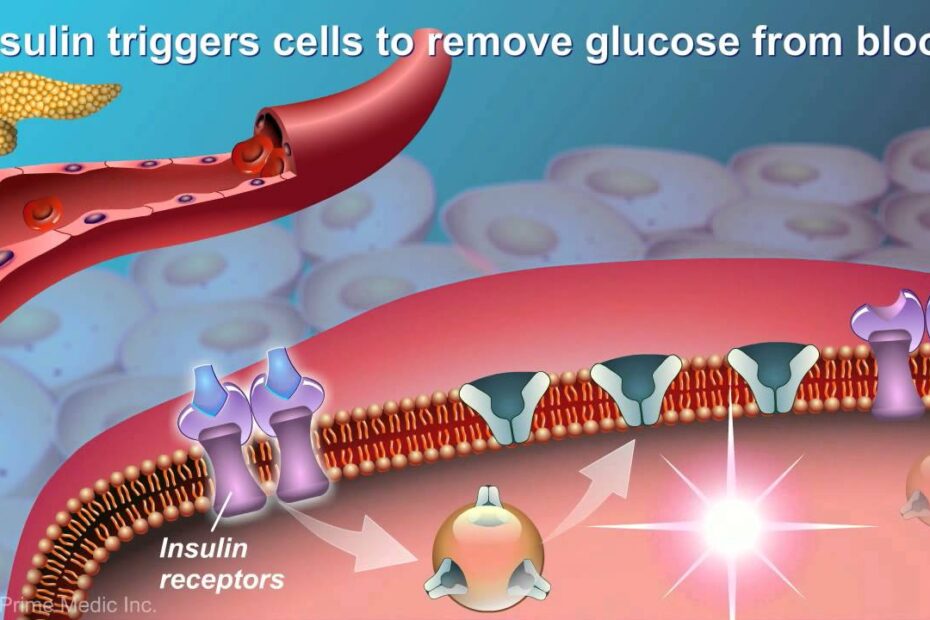 type 2 diabetes technology
