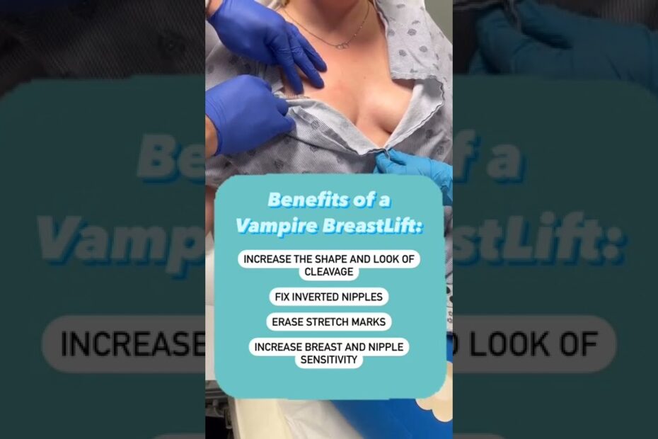 vampire breast lift california