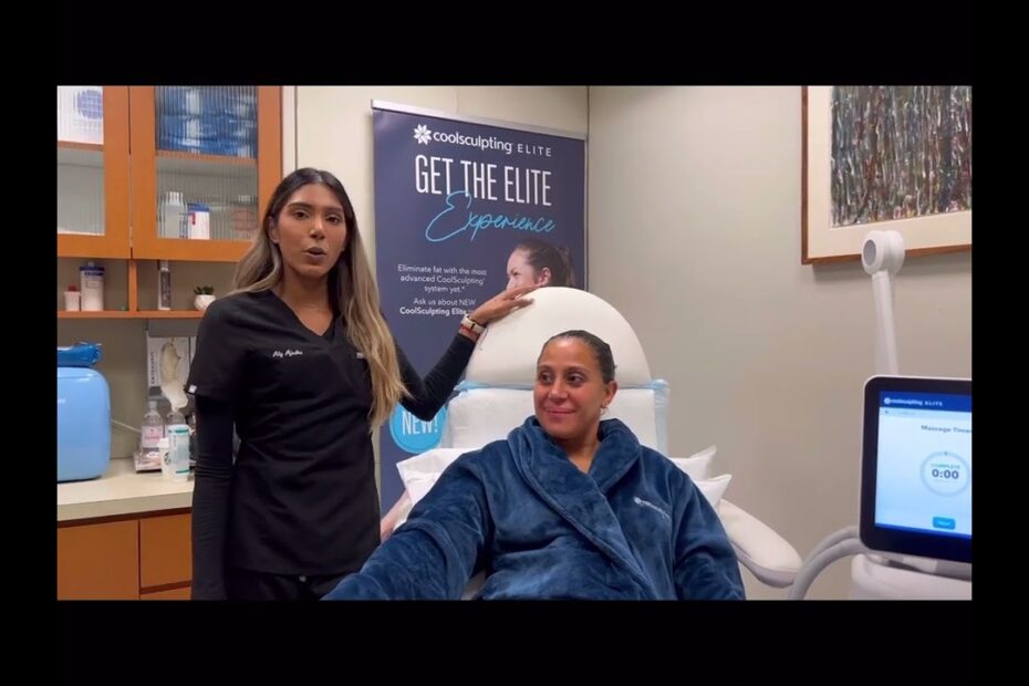 coolsculpting for older women