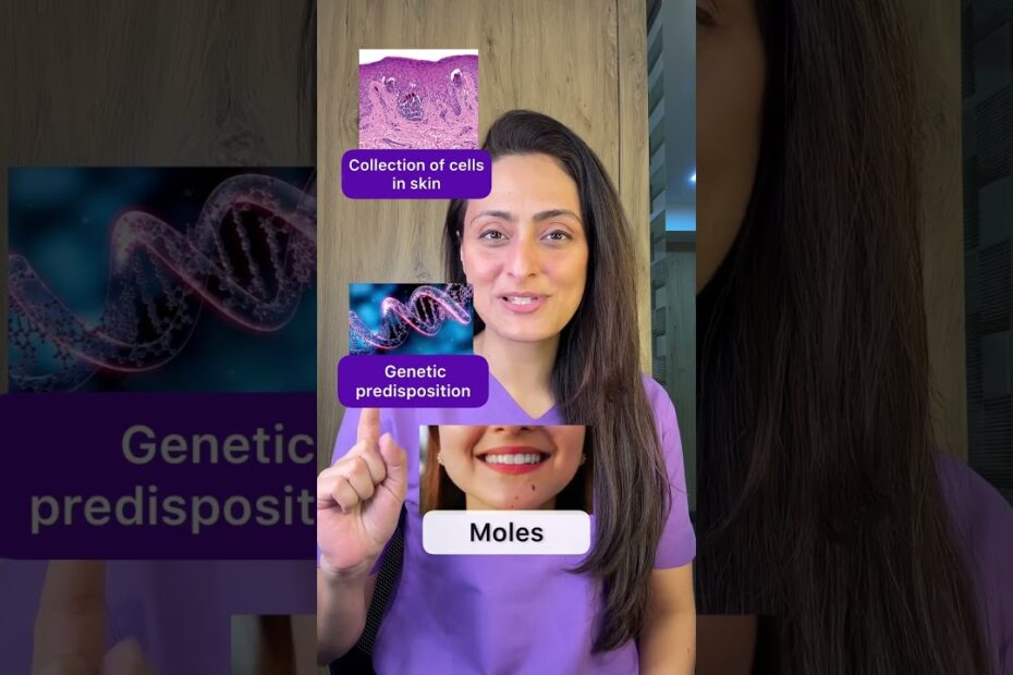 how to get rid of a mole