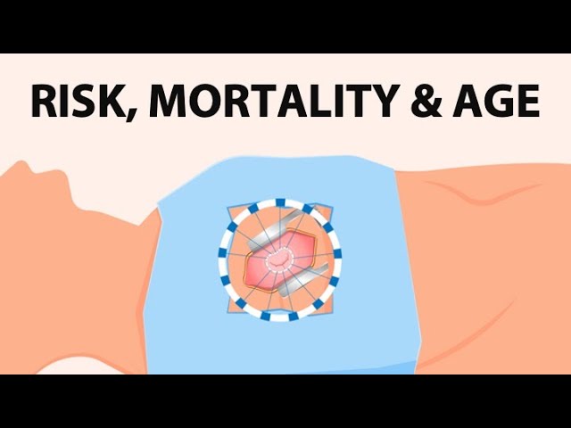 how to know if you have heart valve issues-how to know if you have heart valve issues us