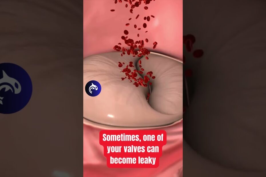 How to Know If You Have Heart Valve Issues: Early Warning Signs and Symptoms 5 how to know if you have heart valveissues-how to know if you have heartvalve issues us