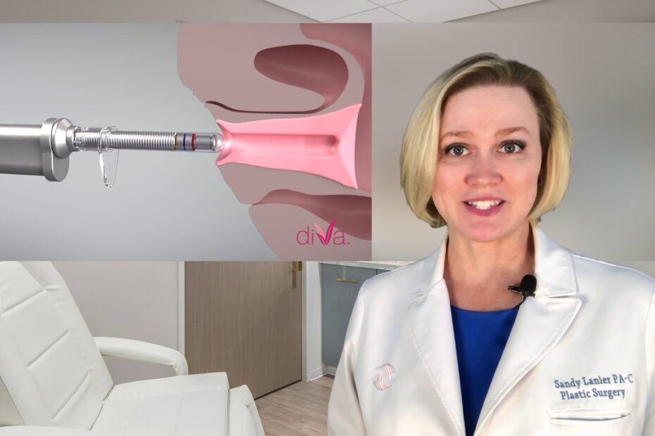 Vaginal Rejuvenation Laser: Transform and Rejuvenate Naturally 5 vaginal rejuvenation laser